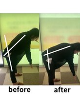 うらら整骨院/腰の前屈がここまで変わる！