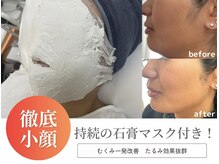 サロンピュア 所沢店の雰囲気（たるみ・顔のむくみお任せください！）