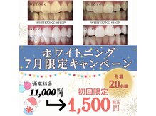 ホワイトニングショップ 山科店