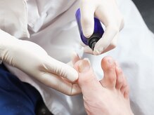 ぱんだ鍼灸接骨院 明里橋院/施術の流れ　STEP1　消毒