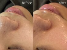 テオリア(TEORIA)/