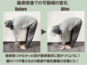 STRETCH LIVERA 北千住店/ストレッチ リヴェラ/前屈可動域の変化