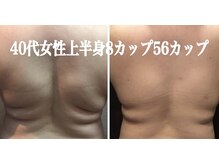 アリス 赤坂の雰囲気（背中の贅肉やたるみにお悩みの方）