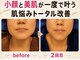 オンリーホープ(ONLY HOPE)の写真