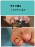 隠れ食い込み爪や巻爪のお悩みにネイルケア+巻き爪矯正フラットジェル2か所