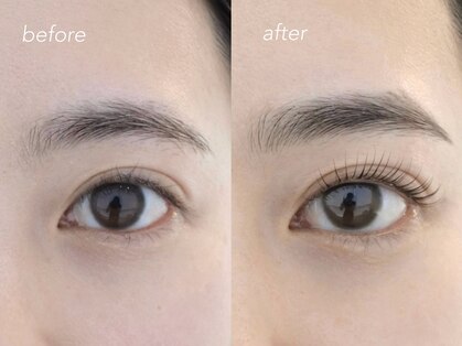 ネストアイ(NEST eye)の写真