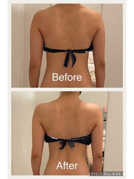 いおり骨盤整体 リブート(RE:BOOT)/セレクト痩身