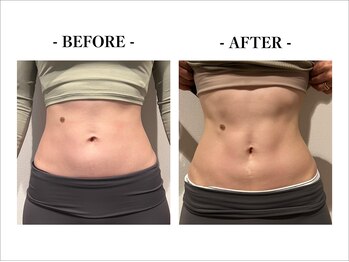 ルア(Lua)/Before/After