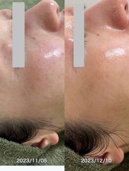 サロンドジェシカ(salon de Jessica)/プラズマ