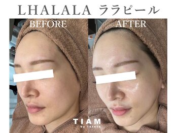 ティアム バイ テトテ 神戸三宮(TIAM by tetote)/ LHALALA ララピール