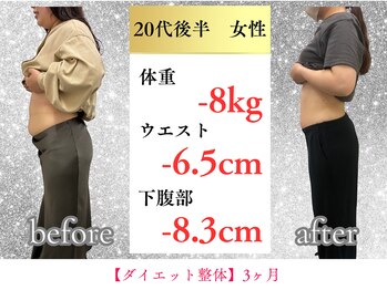 ボディメイク アールエフ サクラ接骨院(bodymake RF SAKURA接骨院)/20代　3ヶ月で体重ー8kg