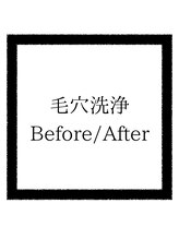 クリアボックス(Clear box)/本気の毛穴洗浄！男女共に大人気