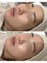 ソワナ(soina)/【神楽坂駅/フェイシャル/毛穴】