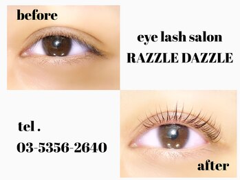 ラズル ダズル(RAZZLE DAZZLE)/ビフォー→アフター♪