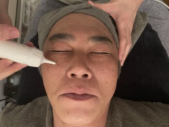 ルース(LUZ)/メンズも気になる顔のシミケア