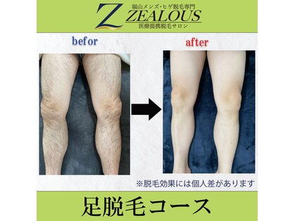 ゼラス 福山店(ZEALOUS)の写真