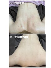 サロン バイオビオ(SALON BioBio)/
