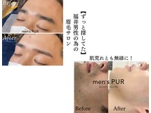 ピュール 鯖江店(PUR)/【メンズ眉 +ヒゲ脱毛】