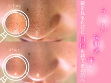 リセットプラス(Reset+)