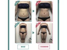 レニフォーメン(reni for men)/【引き締め痩身★】