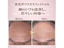 武蔵小杉リンパサロン かおりの部屋の雰囲気（毛穴ケア♪ソフトダーマ＆日本初ボツリヌス配合美容液で水光肌に）