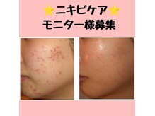 サロンローズ(Salon Rose)