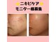 サロンローズ(Salon Rose)の写真