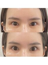 ラ クレール ビューティーサロン(LA CLAIR)/目元のたるみ改善