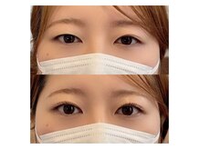 レナータ(RENATA)/