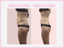 スリムライン 盛岡店(The Slim Line)/before→after