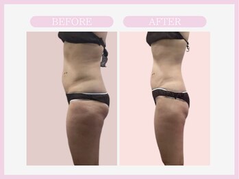 スリムライン 盛岡店(The Slim Line)/before→after