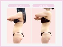 スリムライン 仙台店(The Slim Line)/before→after