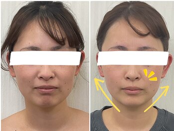 ステイゴールド美容整体院(STAY GOLD)/顔の歪み気になりませんか？