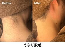 ギルドハナレ(GUILD HANARE)/"ムダ毛ケア"