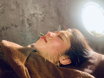 ヘッドサイエンス(HEADSCIENCE)/痛みの少ないリラックス美容鍼