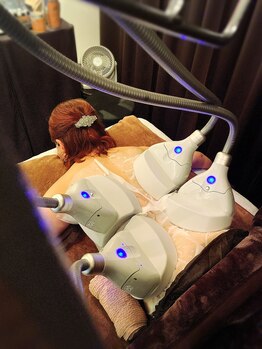 ブルースター(Blue Star)/脂肪冷却4カップ施術風景