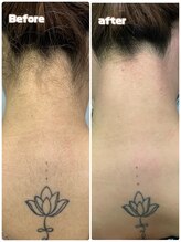 エリーザベル(Elisa Bell)/うなじ&背面ワックス