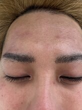 リコリス(Lycoris)/毛穴洗浄