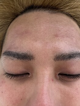 リコリス(Lycoris)/毛穴洗浄