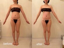 クロレ 浦和店(CLORE)/20代のお客様/4回施術