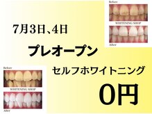 ホワイトニングショップ 静岡葵区店