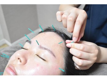 ドリームスタイル 川崎駅前(Dream Style)の写真/女性鍼灸師★独自MENU美容鍼×ヒト幹[レアリゼフェイシャル]で小顔/美肌/エイジングケア♪秋の疲れ顔解消!