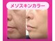 アン 銀座(ann)の写真/【銀座、東銀座】話題のレッドショットで即効ハリ艶肌へ
