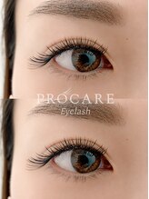 プロケア 新宿本店(PROCARE)/フラットラッシュダブル100束