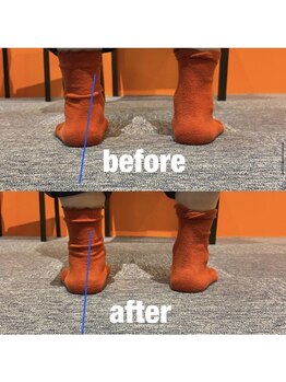 カワル整体 上通り院/【親指付け根の痛み】