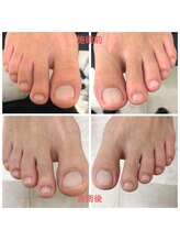 ココネ(cocone)/スペシャルフットケア