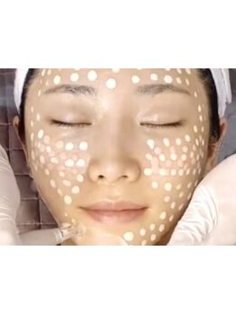 ハリツヤをUPしたい