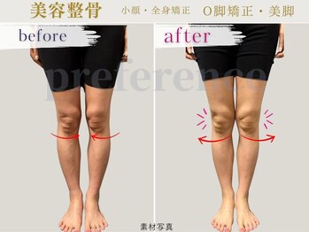 プレフェランス(Preference)/足つぼ/痩身/もみほぐし/骨盤