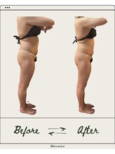 ドゥ ドルチェ(Due dolce)/足がまっすぐに　4回目のお客様