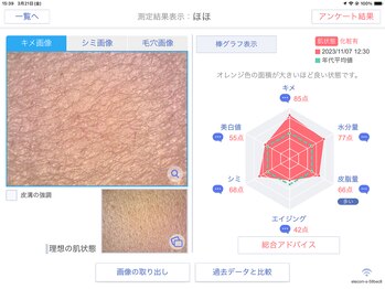 リンド エステ まつげ 京成大久保(Lind)/肌診断